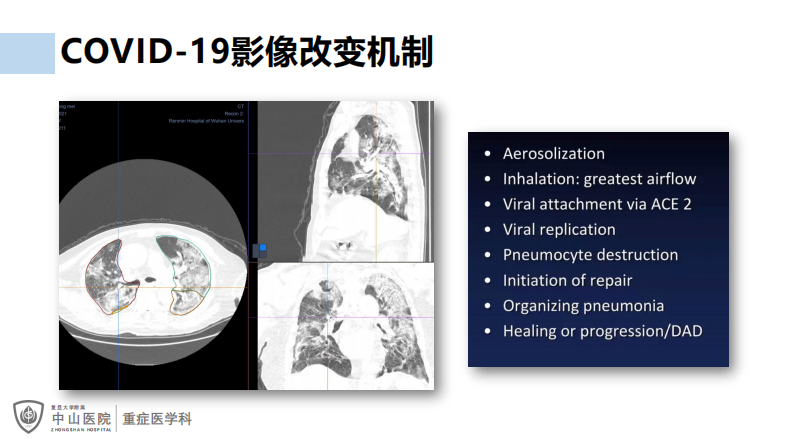 罗哲：COVID19治疗和AI-CT.pdf 第4页