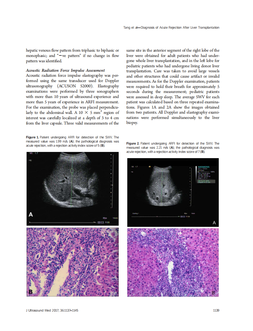 4）Acoustic Radiation Force.pdf 第3页