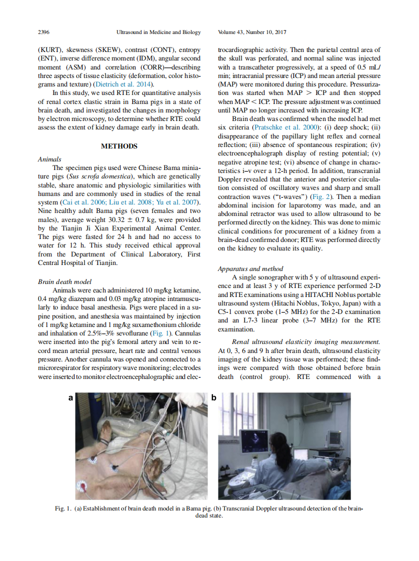 5）Evaluation of early kidney damage caused by brain death  using RTE.pdf 第2页