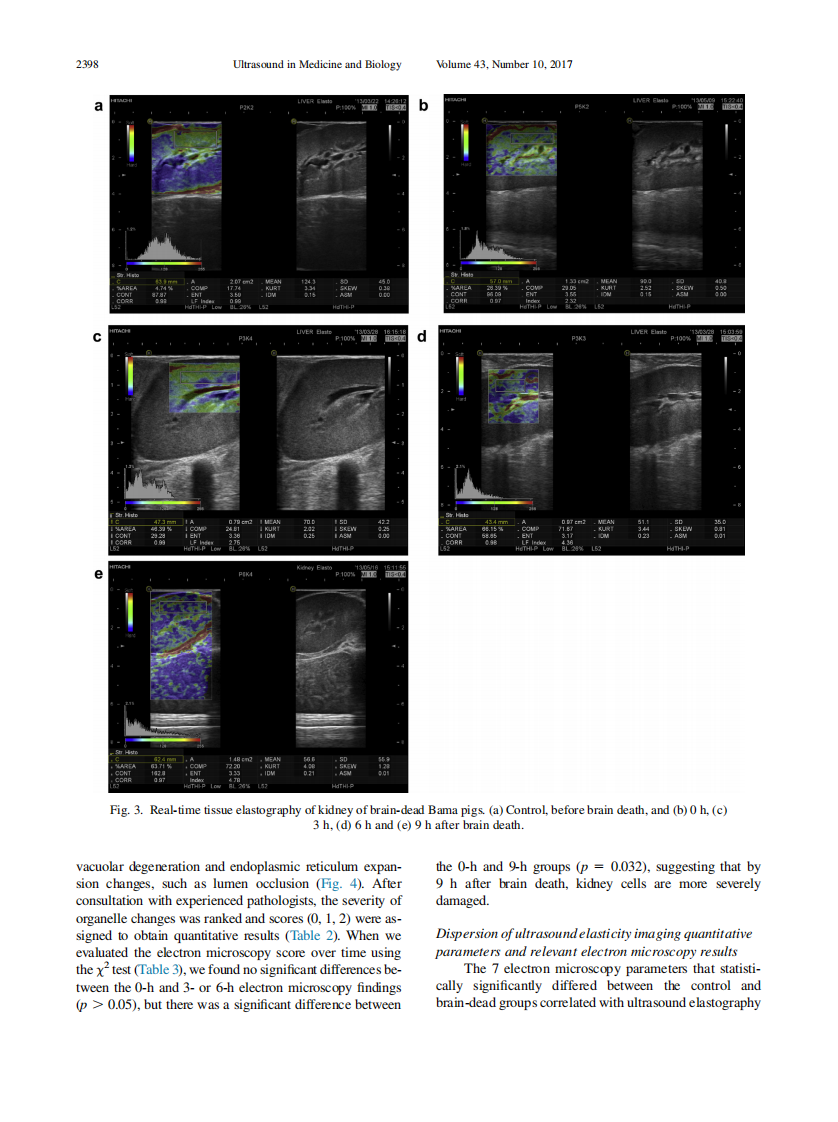 5）Evaluation of early kidney damage caused by brain death  using RTE.pdf 第4页