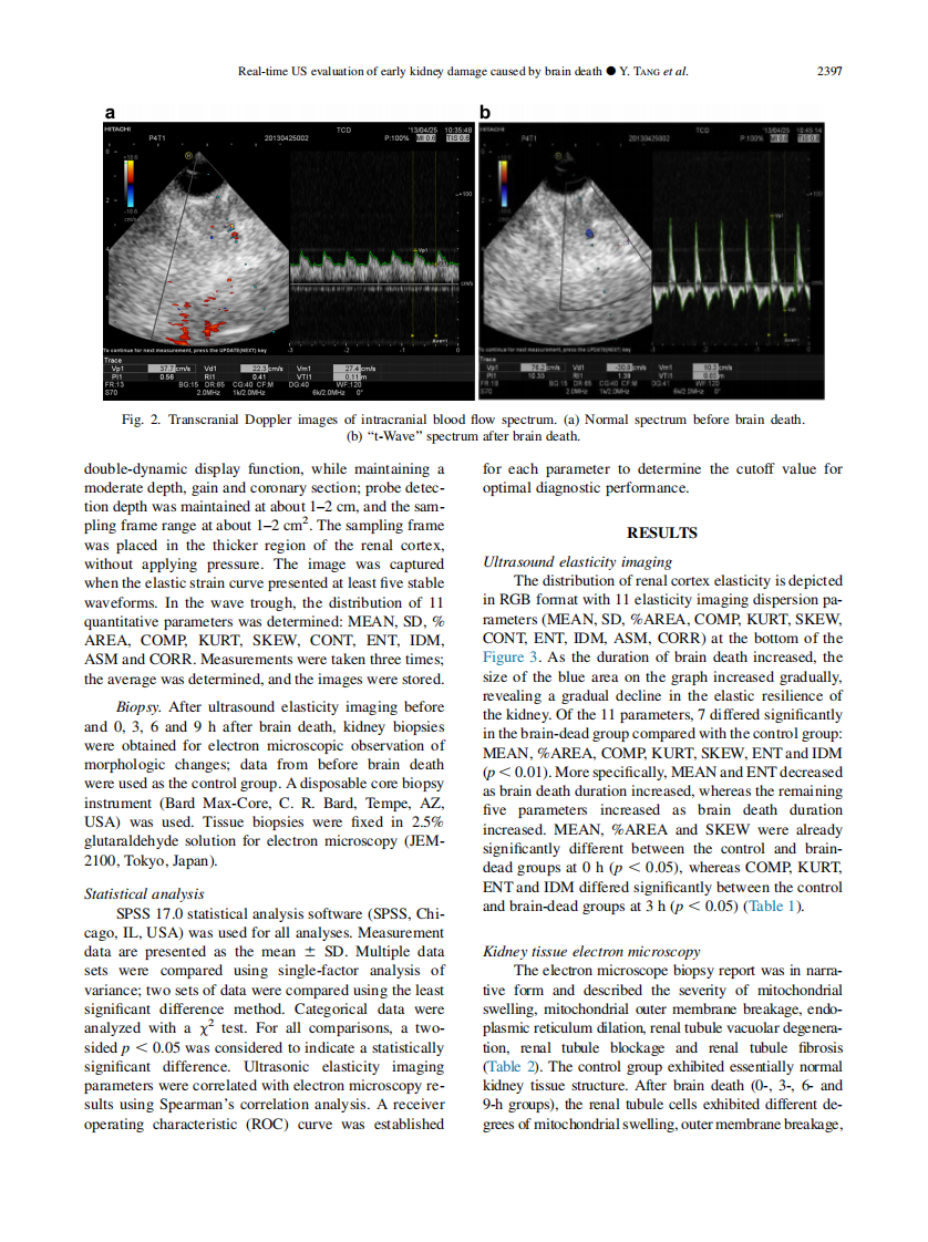 5）Evaluation of early kidney damage caused by brain death  using RTE.pdf 第3页