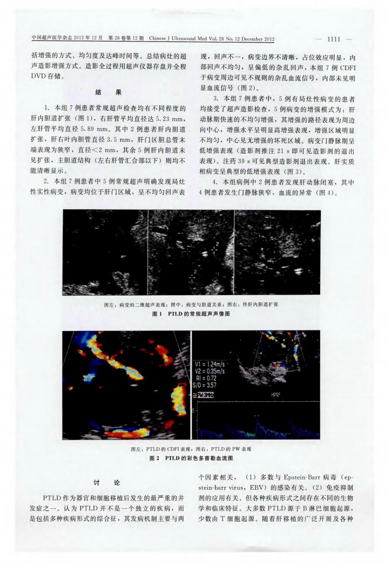 13）肝移植术后淋巴组织增生症的超声检查及超声造影分析.pdf 第2页