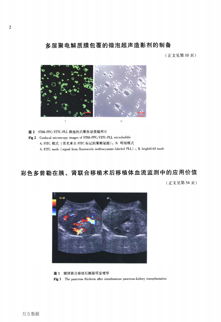 15）彩色多普勒在胰、肾联合移植术后移植体血流监测中的应用价值.pdf 第5页