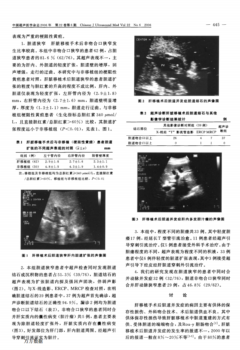 18）肝脏移植术后胆道并发症超声诊断的临床价值.pdf 第2页