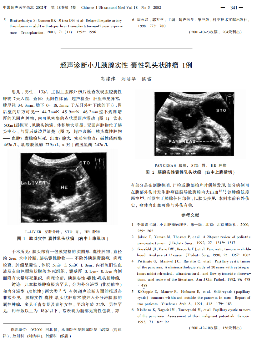 23超声对原位肝移植术后肝动脉并发症诊断新认识.pdf 第4页