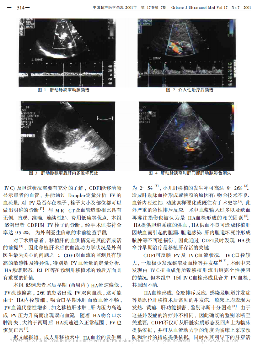 25）彩色多普勒超声对原位肝移植患者血流动力学的研究.pdf 第3页