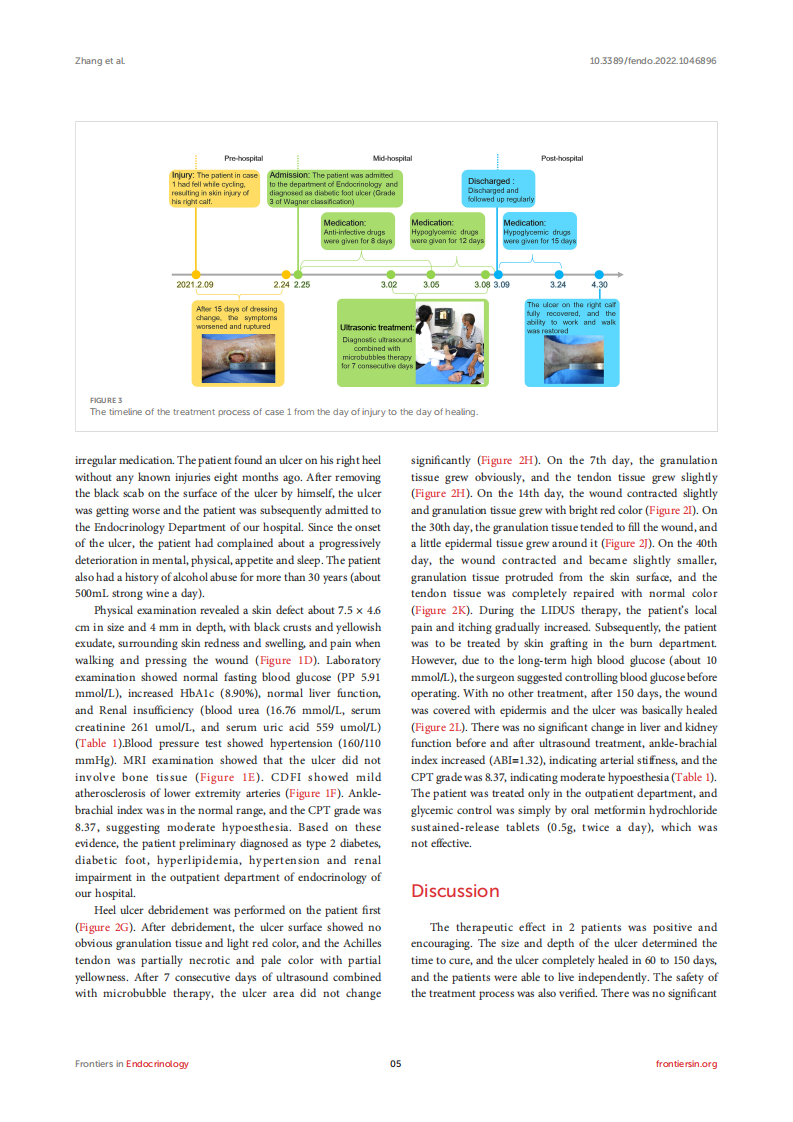 Case report-Successful treatment of human diabetic foot ulcer using low-intensity diagnostic ultrasound combined with microbubbles-Two cases.pdf 第5页