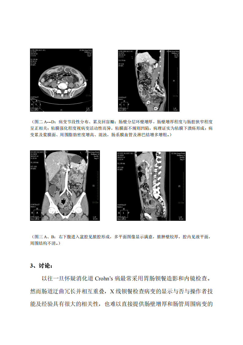 MSCT成像技术在肠道克罗恩病诊断中的应用价值.pdf 第5页
