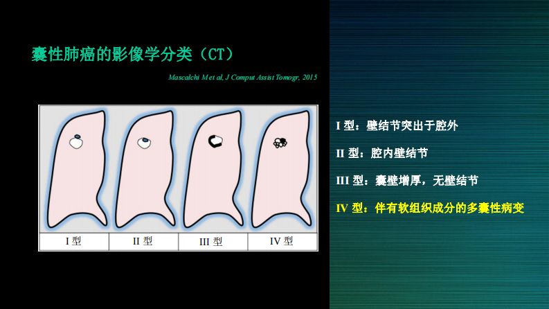 伴囊性空腔肺癌的诊断与鉴别--邢伟.pdf 第5页