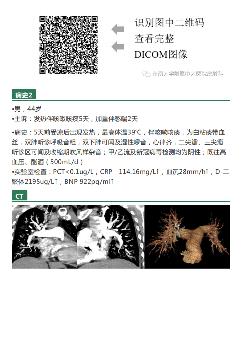 20210412_3【晨读结果公布】2021.04.12呼吸系统疾病——病例1：耶氏肺孢子菌肺炎（PCP）；病例2：急性心源性肺水肿（ACPE）.pdf 第3页