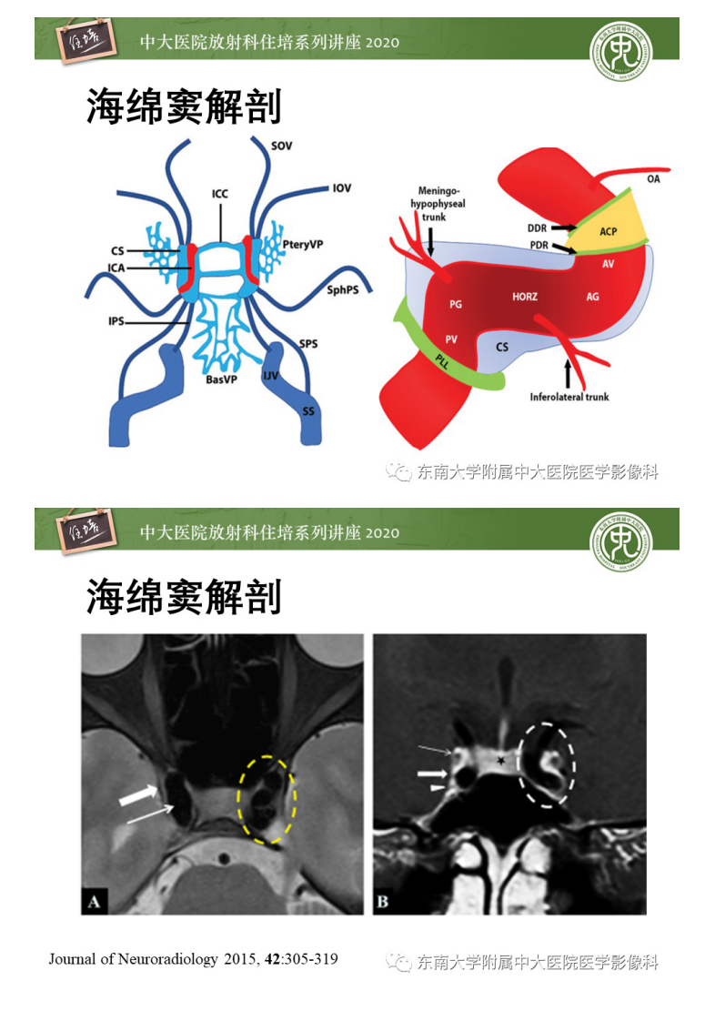 20200830_1【中大放射住培系列讲座】海绵窦区常见病变的影像特征.pdf 第3页