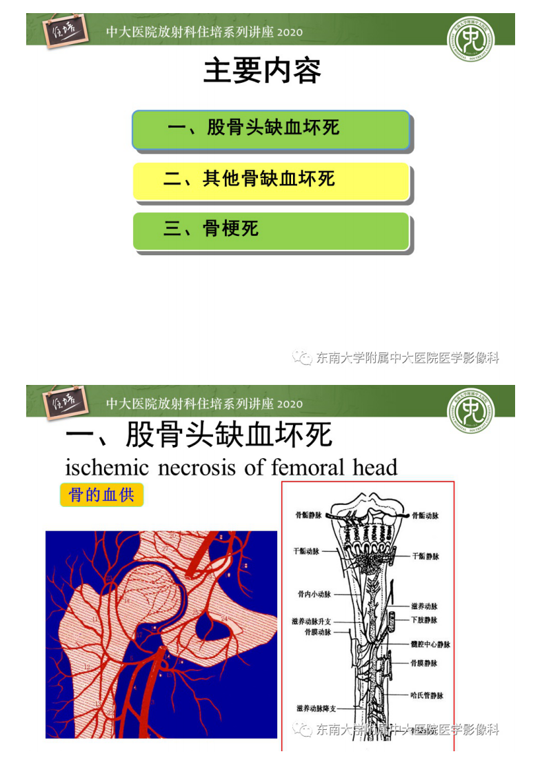 20200509_1【中大放射住培系列讲座】骨缺血坏死性病变的影像学特征.pdf 第3页