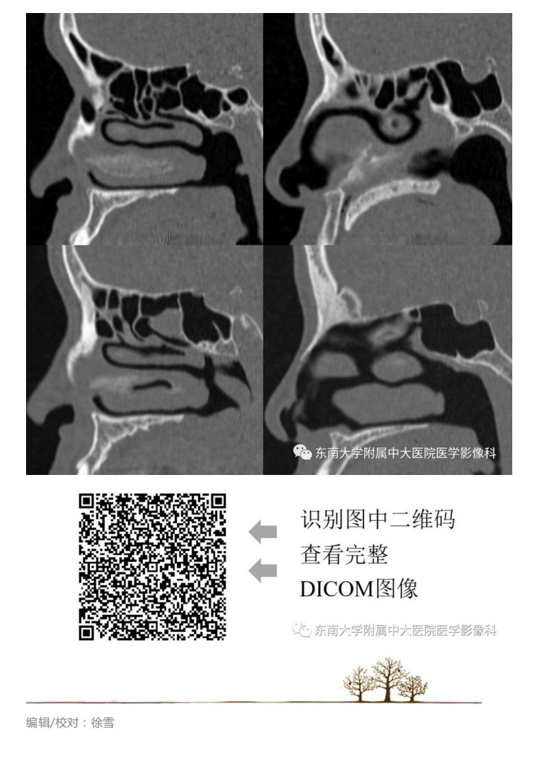 20200707_2【晨读结果公布】2020.07.06头颈部疾病——副鼻窦解剖变异.pdf 第3页