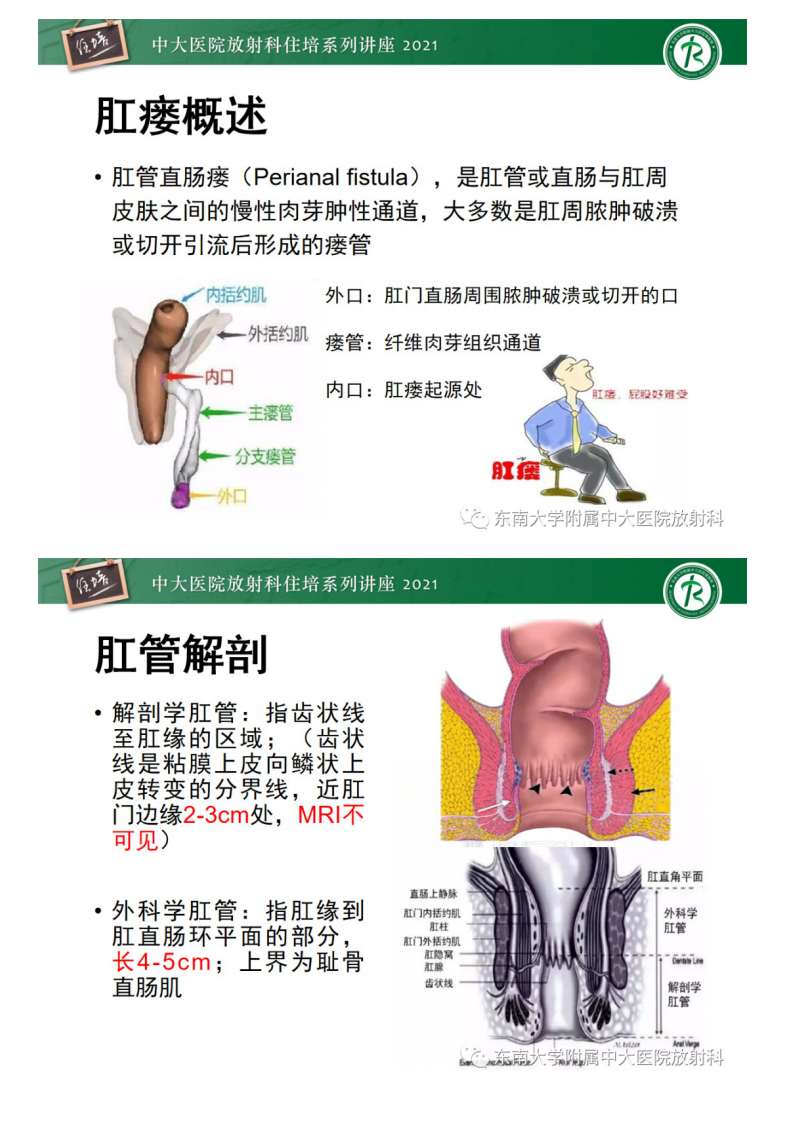 20210601_1【中大放射住培系列讲座】肛瘘的影像诊断及评估.pdf 第2页