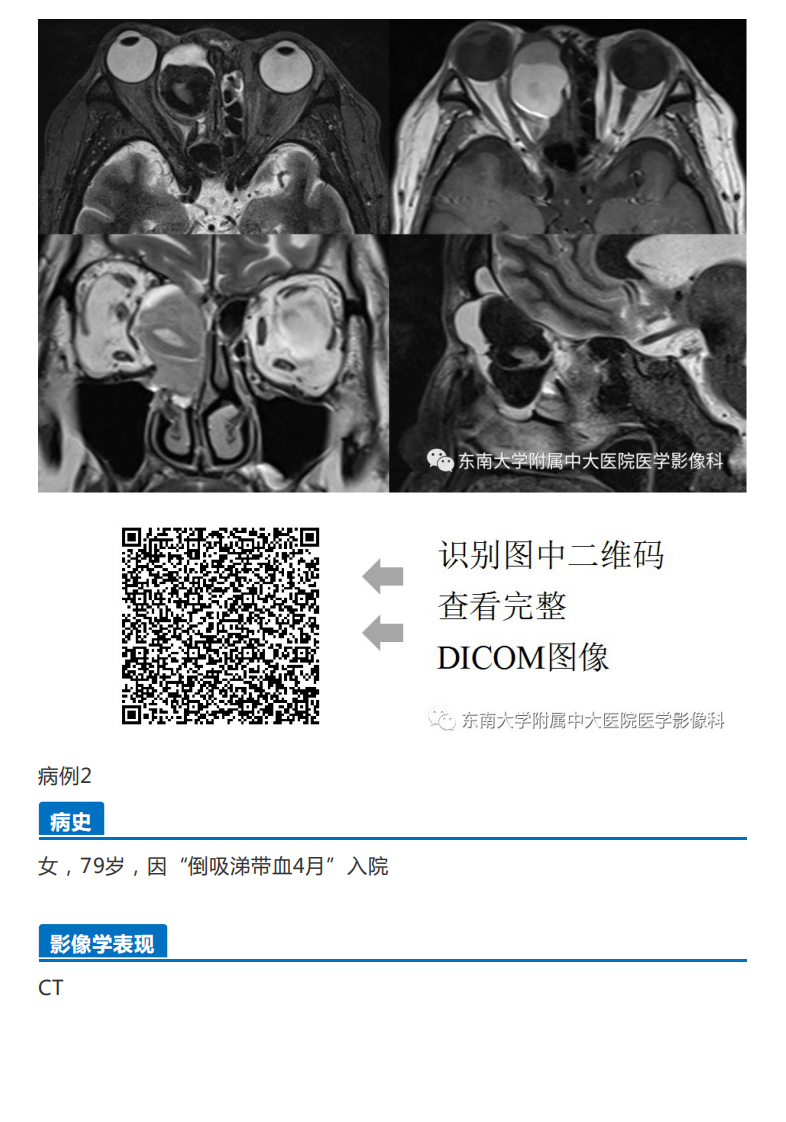 20190325_2【晨读结果公布】2019.03.25头颈部系统疾病.pdf 第2页
