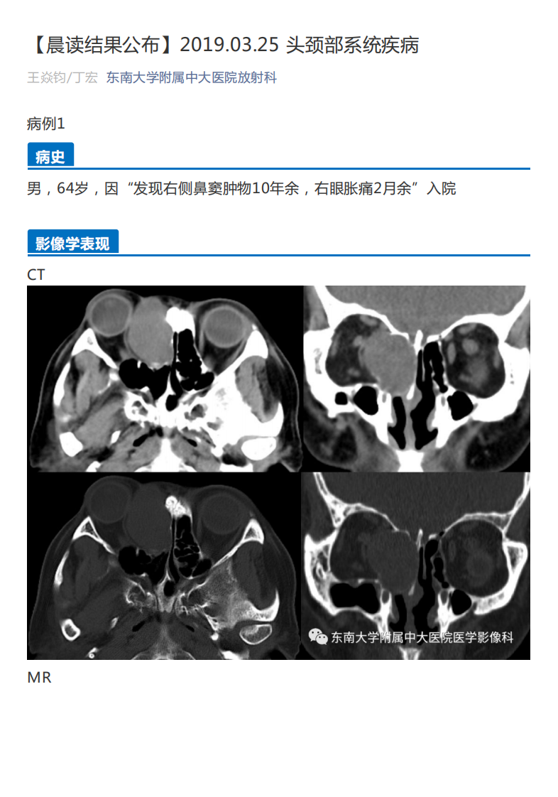20190325_2【晨读结果公布】2019.03.25头颈部系统疾病.pdf 第1页