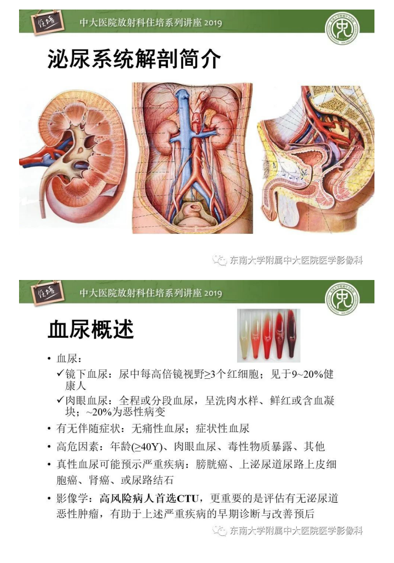 20200319_2【中大放射住培系列讲座】血尿的影像分析思路.pdf 第2页
