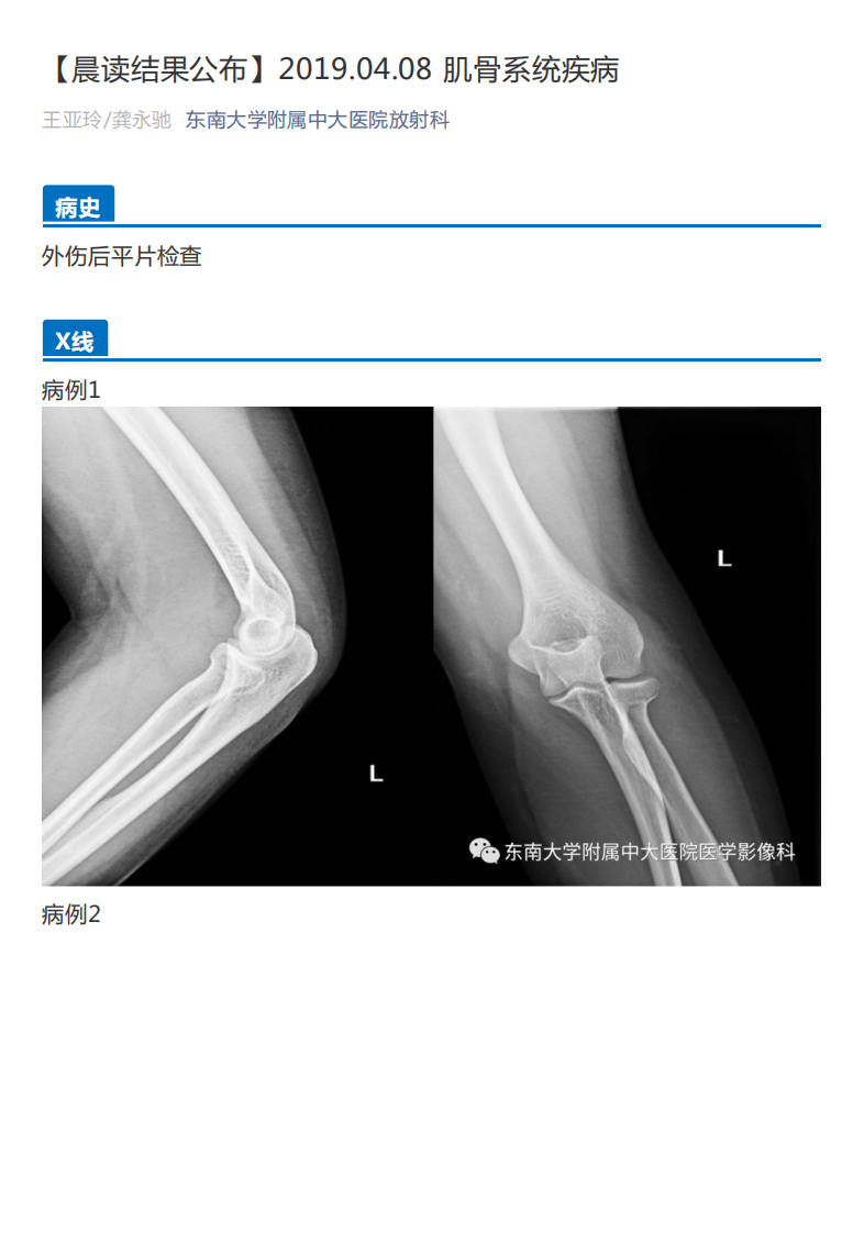 20190409_2【晨读结果公布】2019.04.08肌骨系统疾病.pdf 第1页