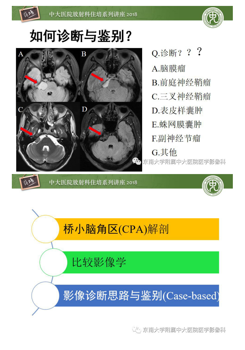 20190609_1【中大放射住培系列讲座第64期】成人桥小脑角区占位性病变影像诊断思路.pdf 第2页