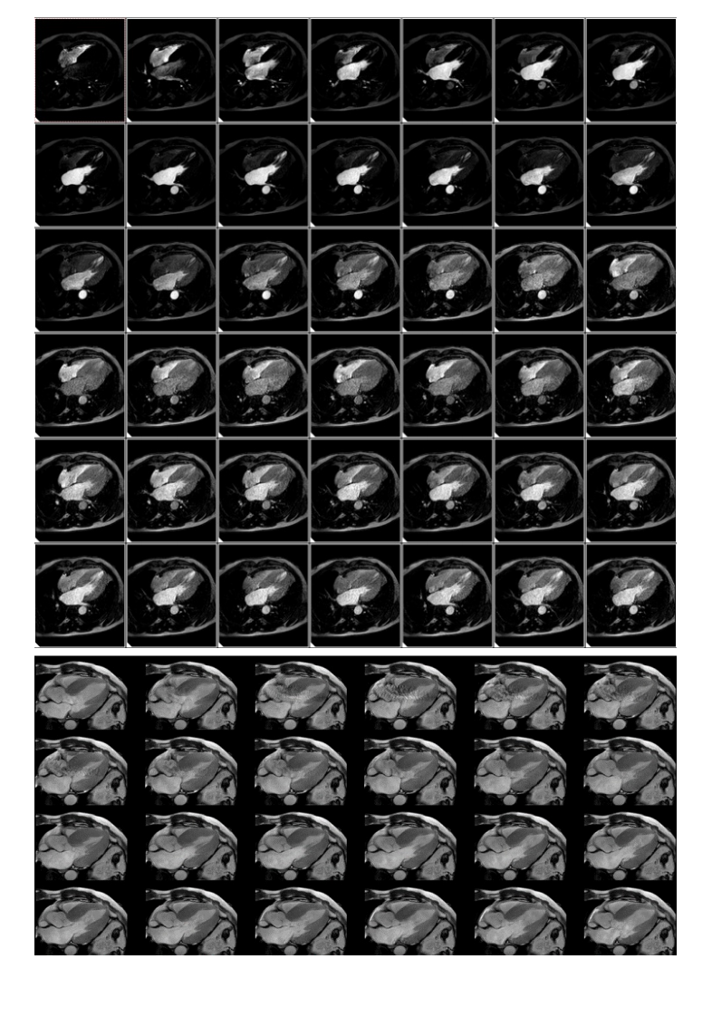 20210601_3【晨读结果公布】2021.05.31循环系统疾病——病例1：肥厚型心肌病；病例2：主动脉瓣膜病变继发改变.pdf 第3页