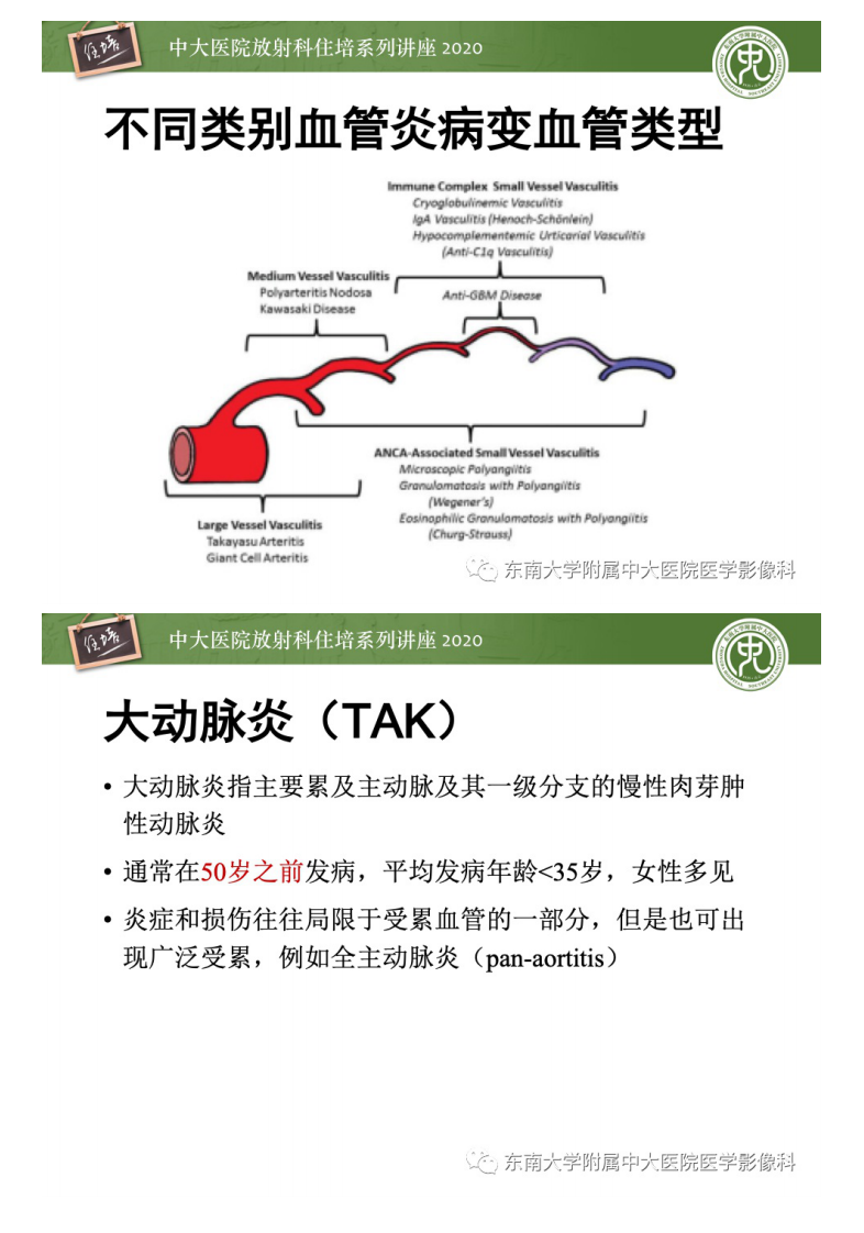 20201220_1【中大放射住培系列讲座】系统性血管炎的CTMR评价.pdf 第4页