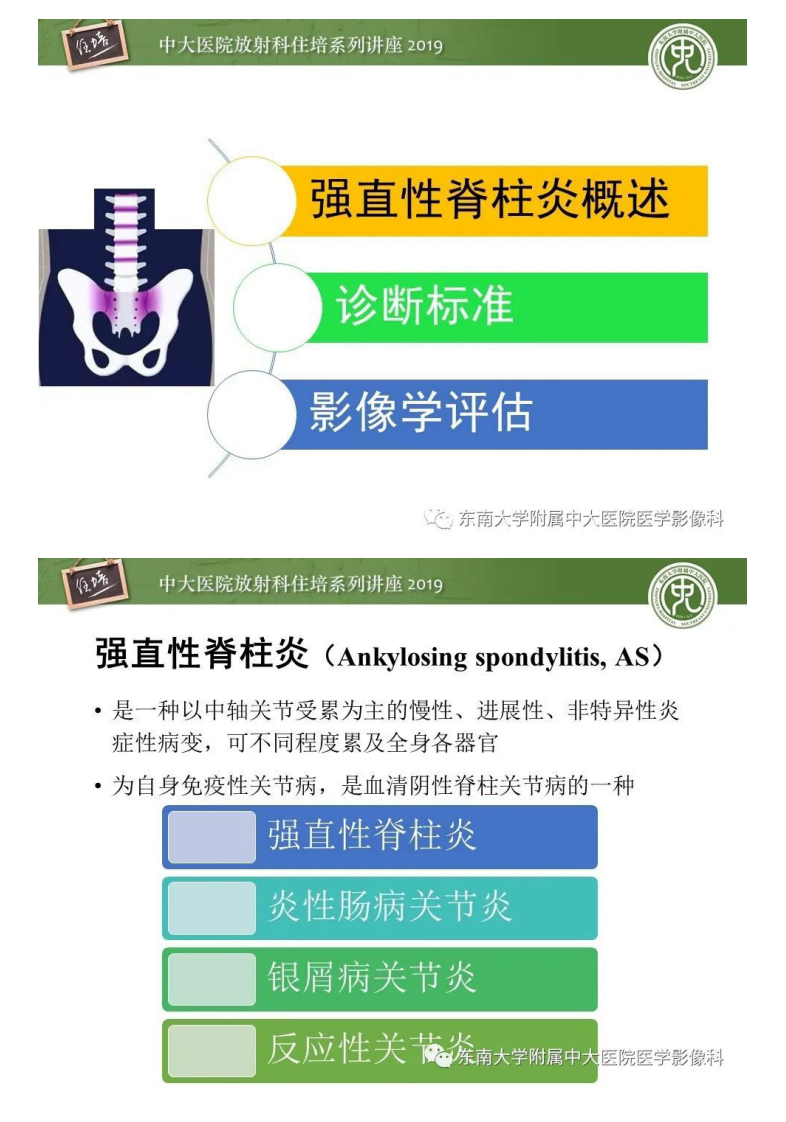20200301_1【中大放射住培系列讲座】强直性脊柱炎影像学评估.pdf 第3页