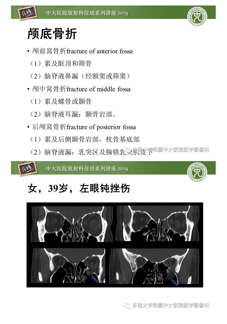 20200203_1【中大放射住培系列讲座】成人颅脑损伤影像评估基本原则.pdf 第3页