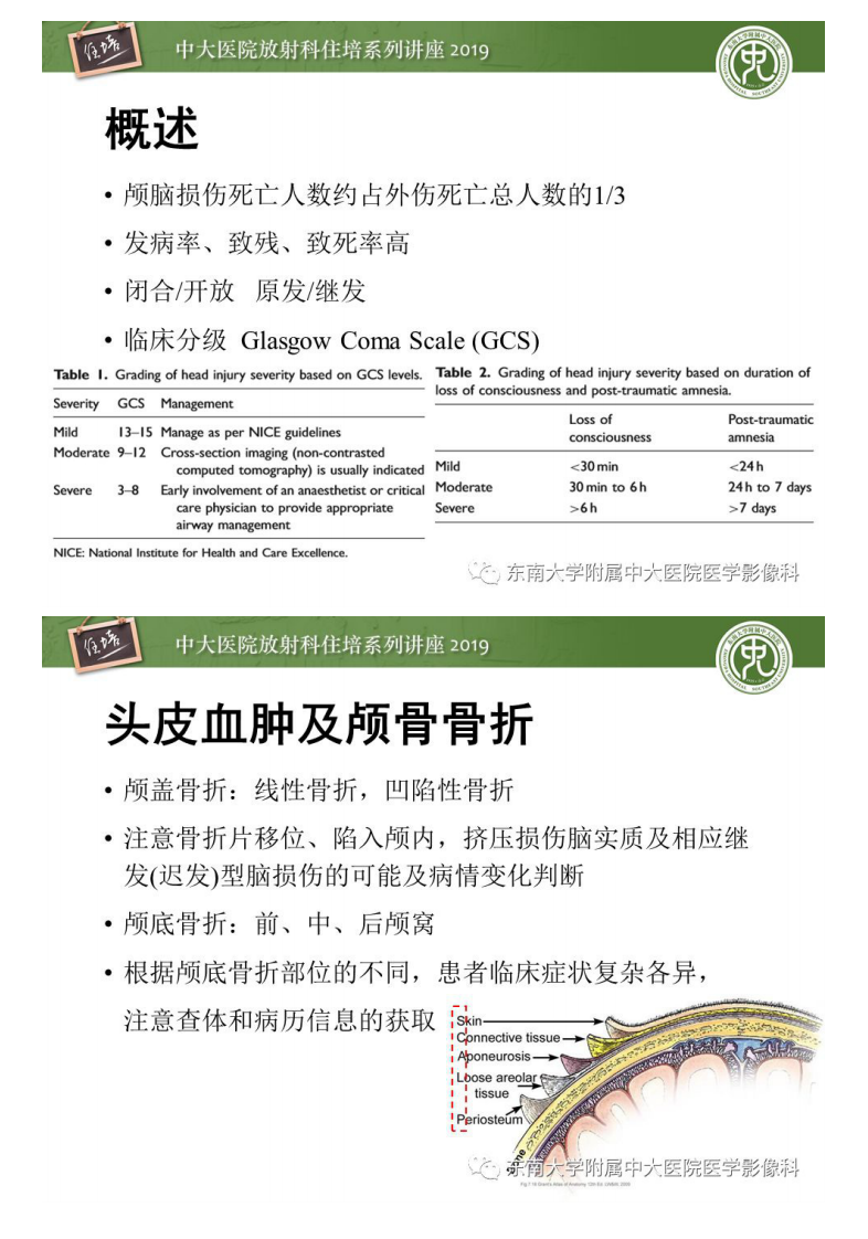 20200203_1【中大放射住培系列讲座】成人颅脑损伤影像评估基本原则.pdf 第2页