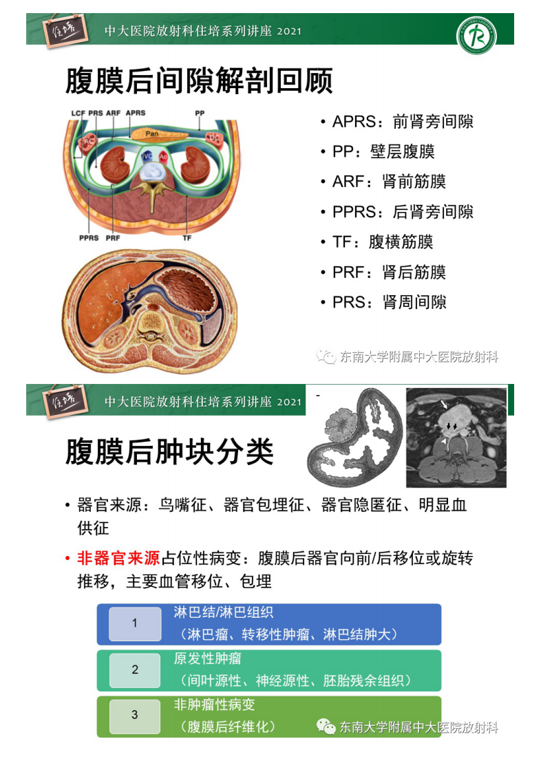 20210621_1【中大放射住培系列讲座】肾上腺外腹膜后副神经节瘤影像诊断思路.pdf 第2页