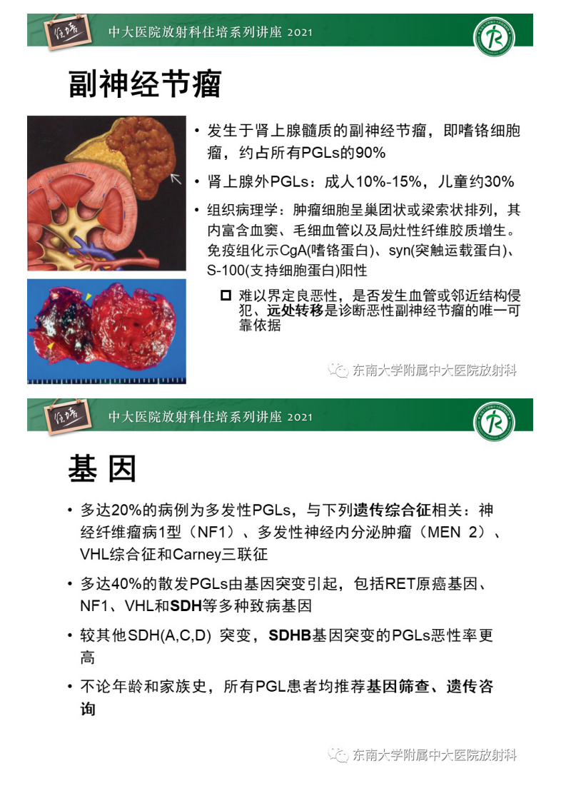 20210621_1【中大放射住培系列讲座】肾上腺外腹膜后副神经节瘤影像诊断思路.pdf 第4页