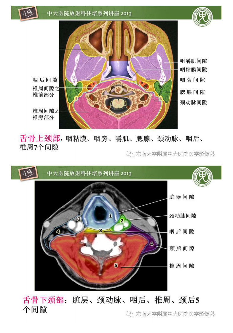 20191215_1【2019住培系列讲座第89期】颈部间隙的影像解剖及诊断思路.pdf 第5页