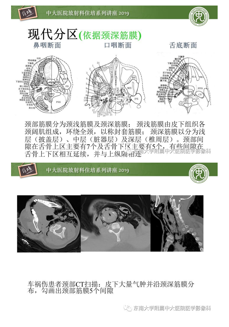 20191215_1【2019住培系列讲座第89期】颈部间隙的影像解剖及诊断思路.pdf 第4页
