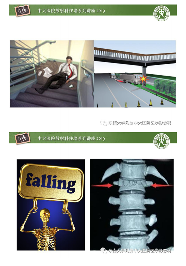 20190915_1【2019住培系列讲座第77期】脊柱创伤.pdf 第2页