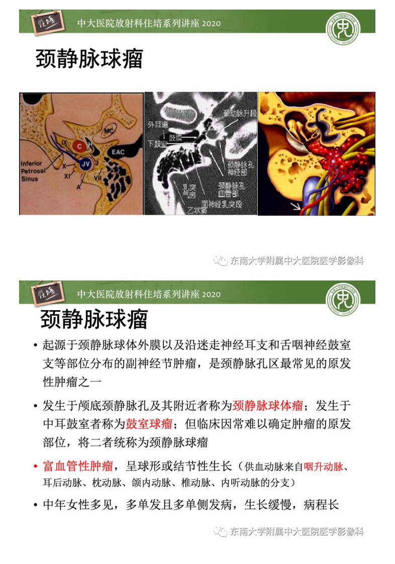 20201228_1【中大放射住培系列讲座】头颈部神经源性肿瘤的影像诊断.pdf 第5页