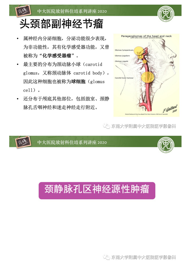 20201228_1【中大放射住培系列讲座】头颈部神经源性肿瘤的影像诊断.pdf 第3页