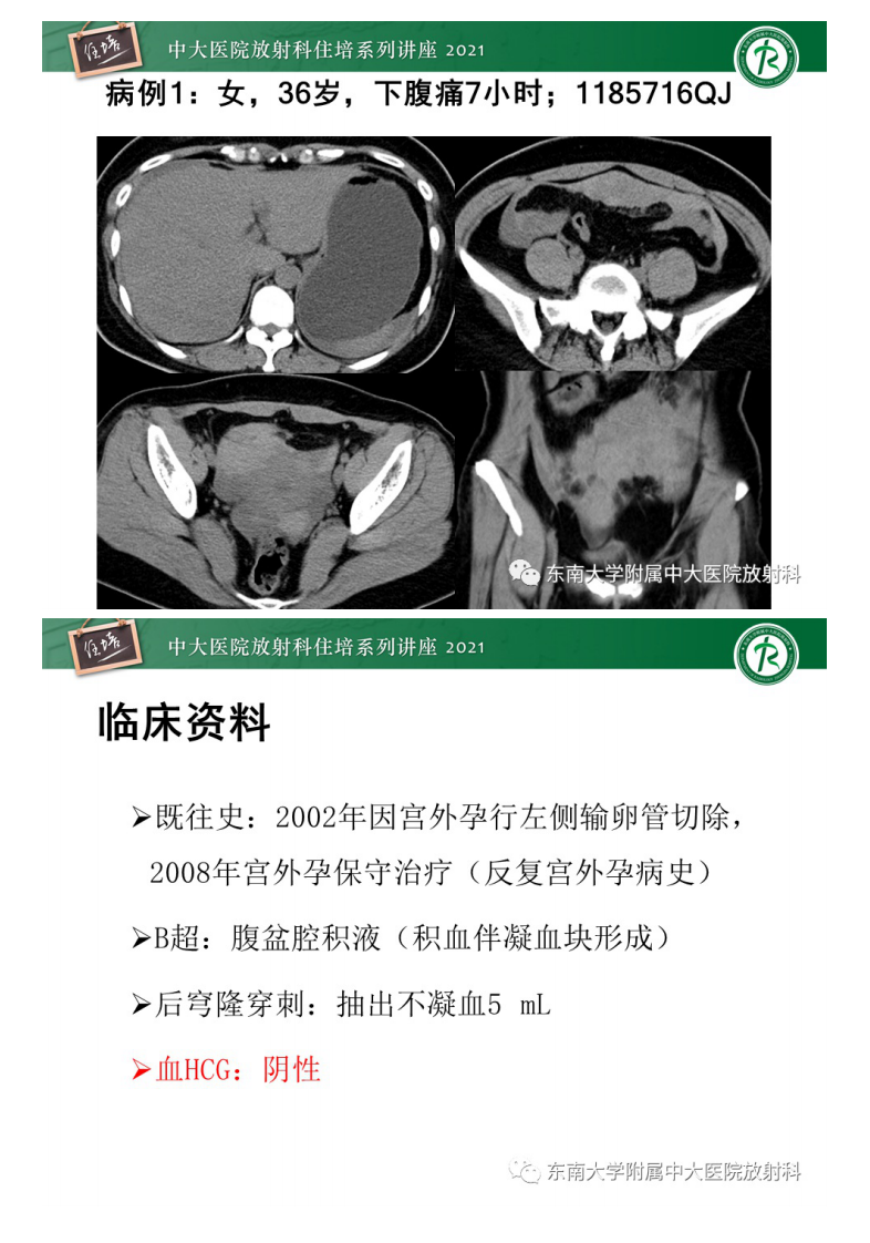 20210627_2【中大放射住培系列讲座】卵巢黄体及相关疾病诊断及鉴别.pdf 第2页