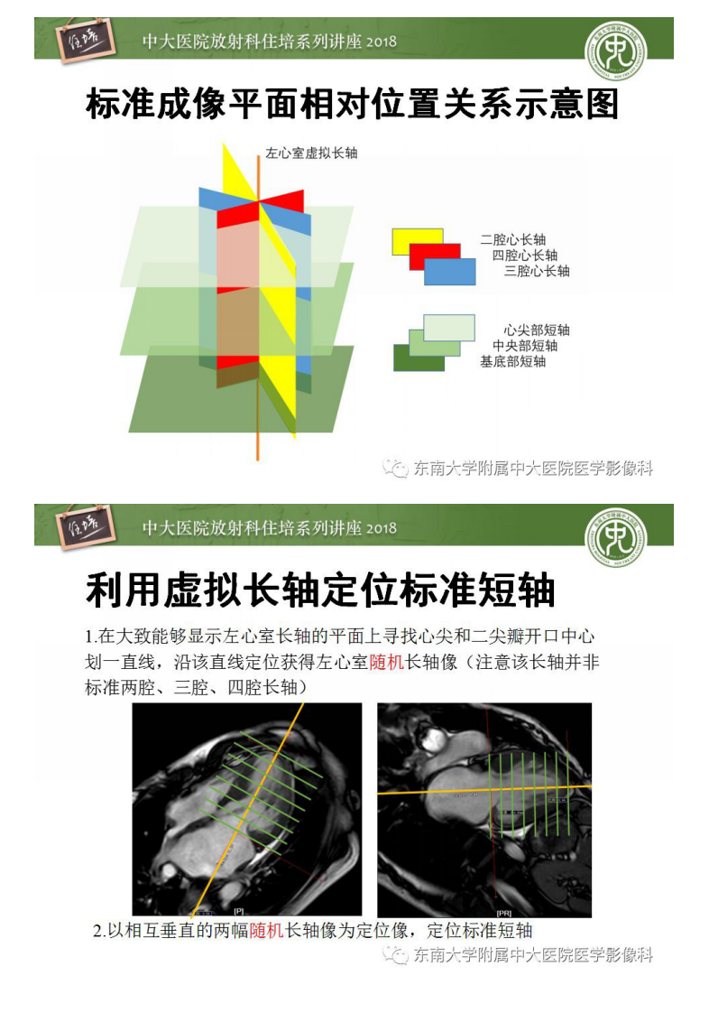 20190202_1【2018住培系列讲座第48期】心脏磁共振成像应用基础.pdf 第4页