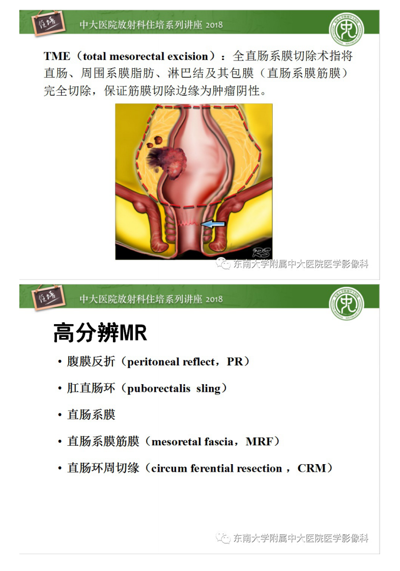 20200409_1【中大放射住培系列讲座】直肠癌MR分期及报告.pdf 第3页