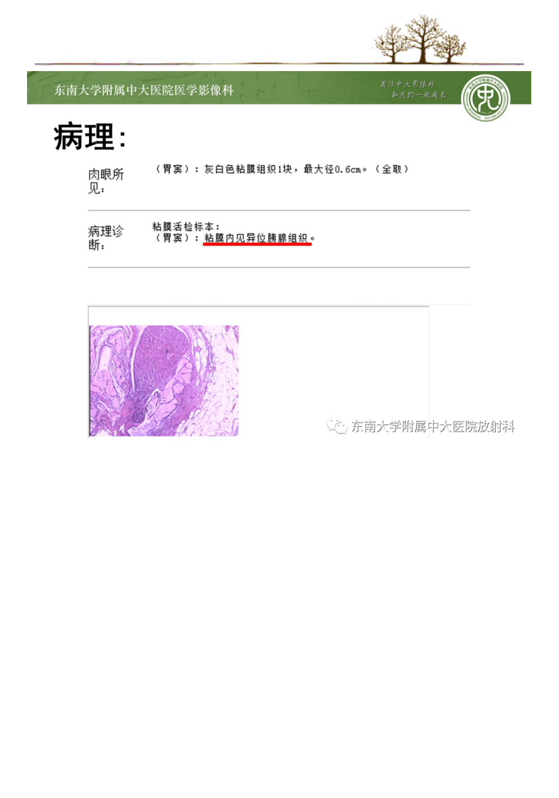 20210113_2【晨读结果公布】2021.01.13消化系统疾病——胃内异位胰腺.pdf 第5页