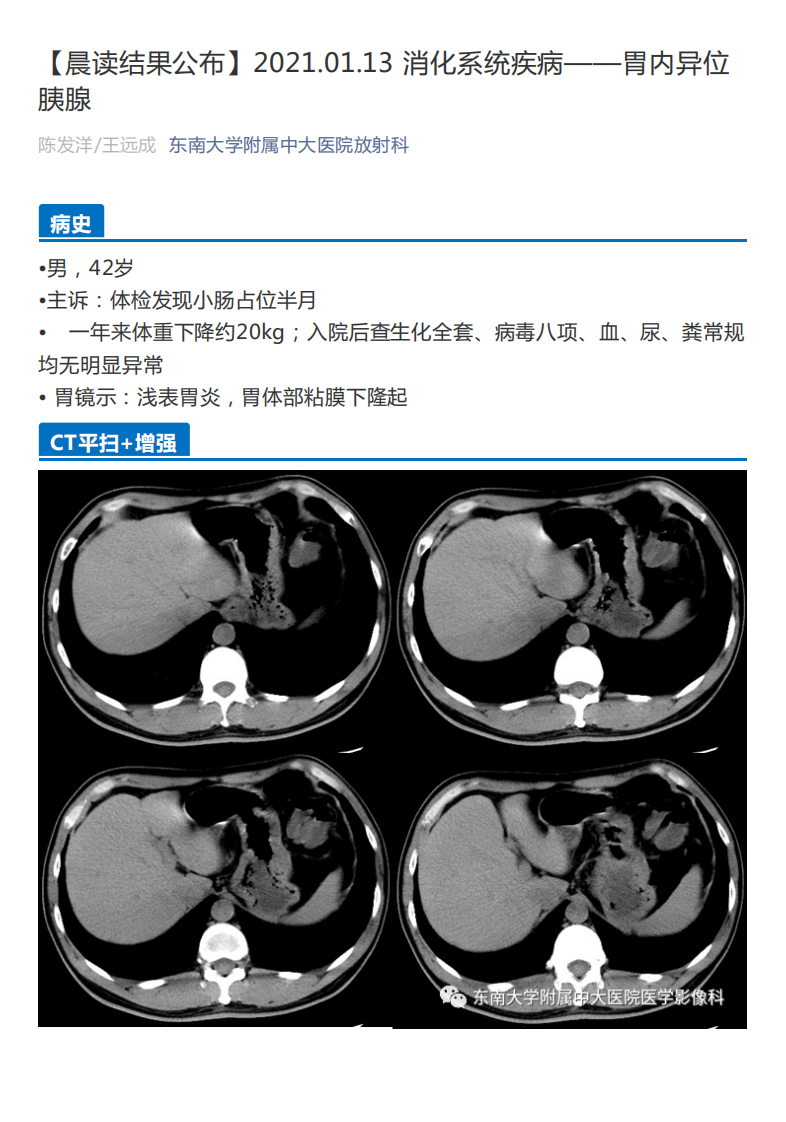20210113_2【晨读结果公布】2021.01.13消化系统疾病——胃内异位胰腺.pdf 第1页