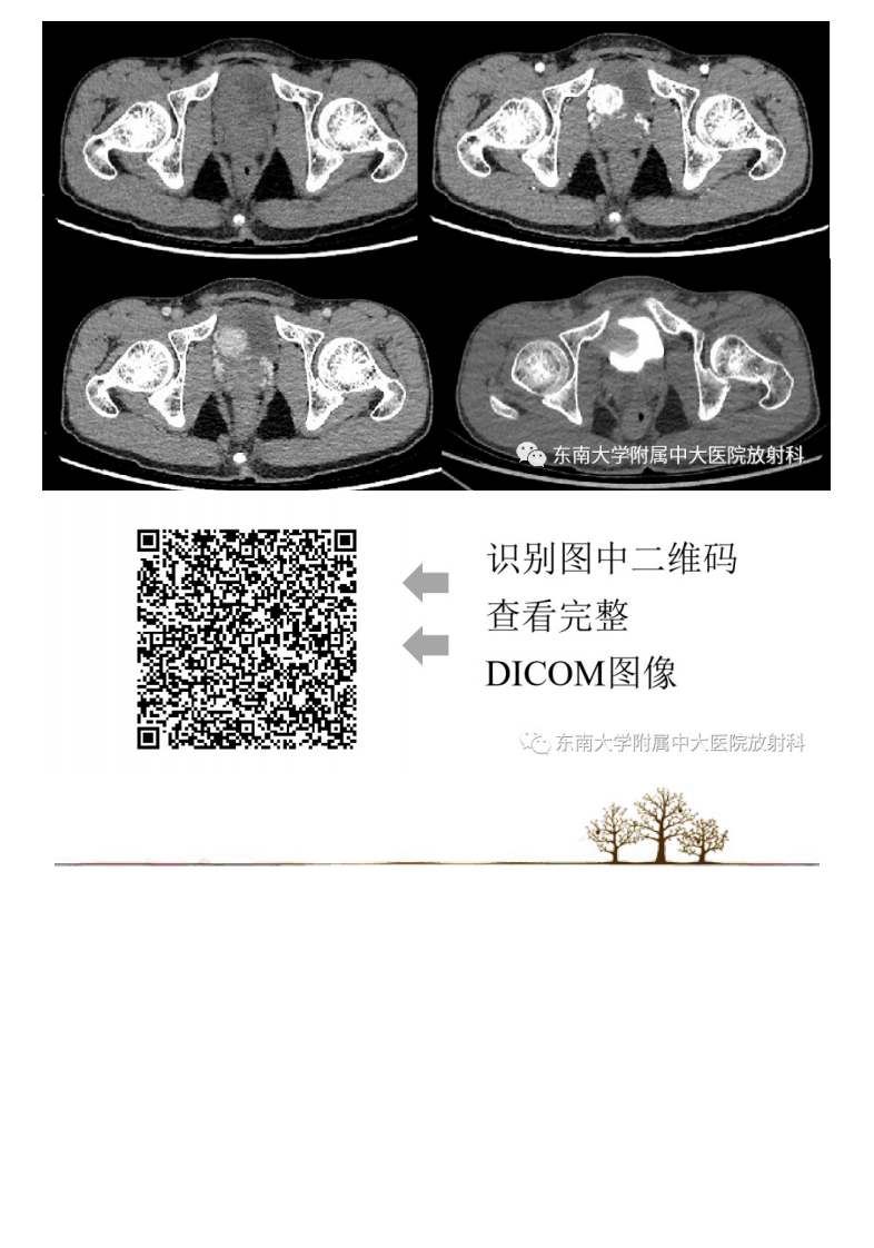 20210319_2【晨读结果公布】2021.03.18泌尿生殖系统疾病——腹膜后副神经节瘤.pdf 第2页
