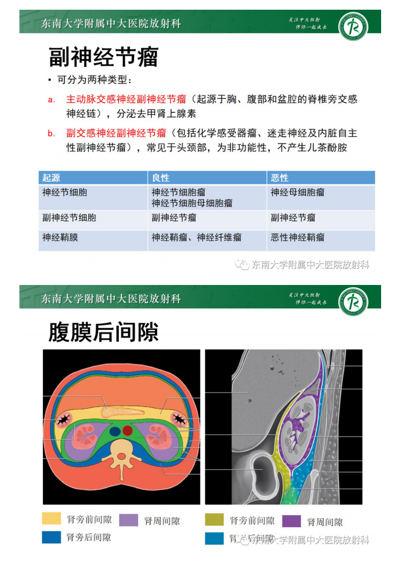 20210319_2【晨读结果公布】2021.03.18泌尿生殖系统疾病——腹膜后副神经节瘤.pdf 第5页