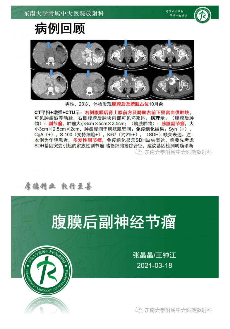 20210319_2【晨读结果公布】2021.03.18泌尿生殖系统疾病——腹膜后副神经节瘤.pdf 第3页
