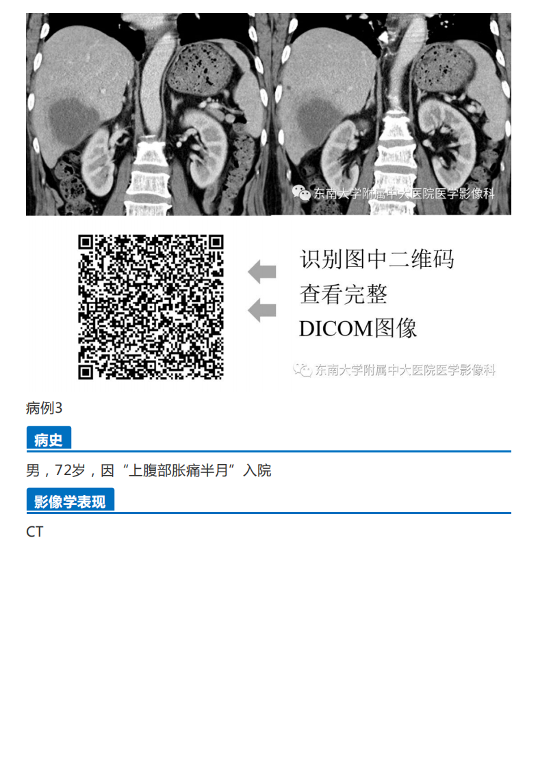 20191230_2【晨读结果公布】2019.12.30消化系统疾病.pdf 第4页