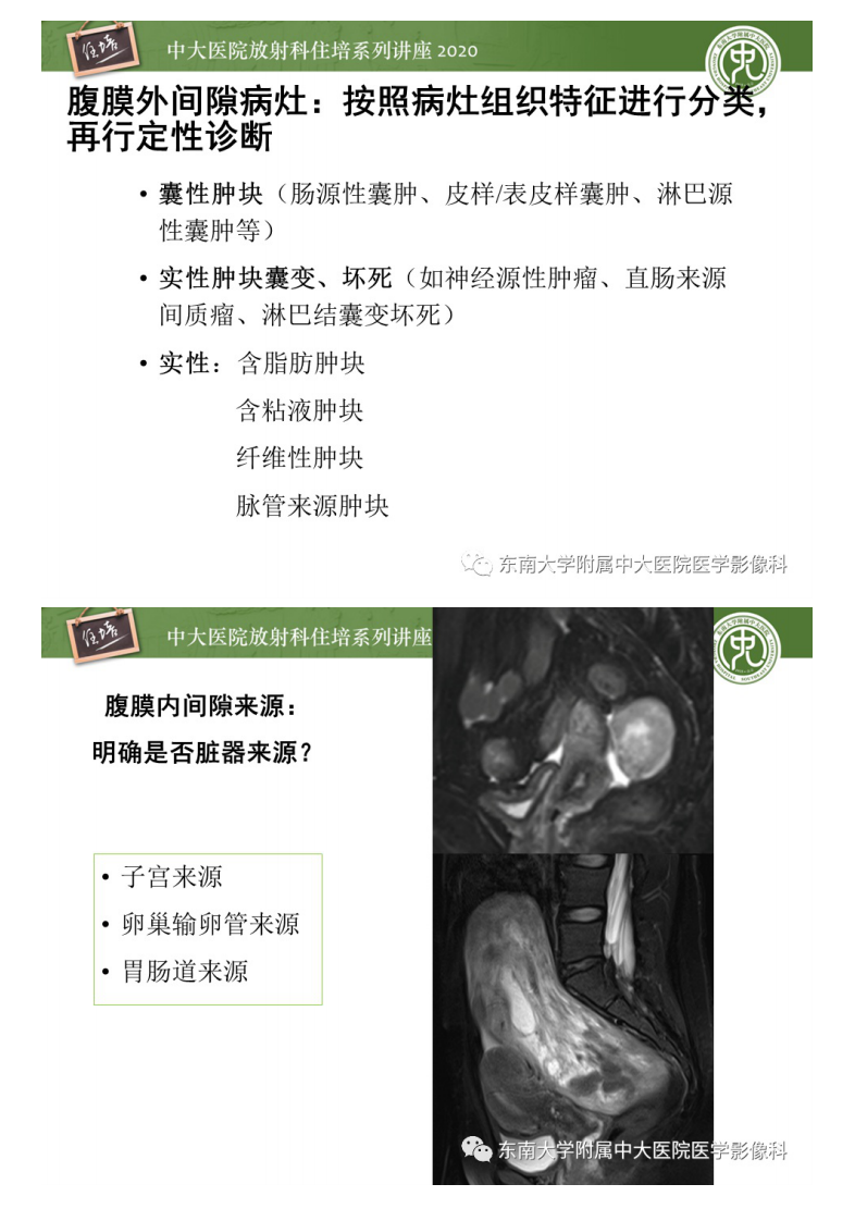 20200413_1【中大放射住培系列讲座】女性盆腔实性占位性病变定位分析.pdf 第5页