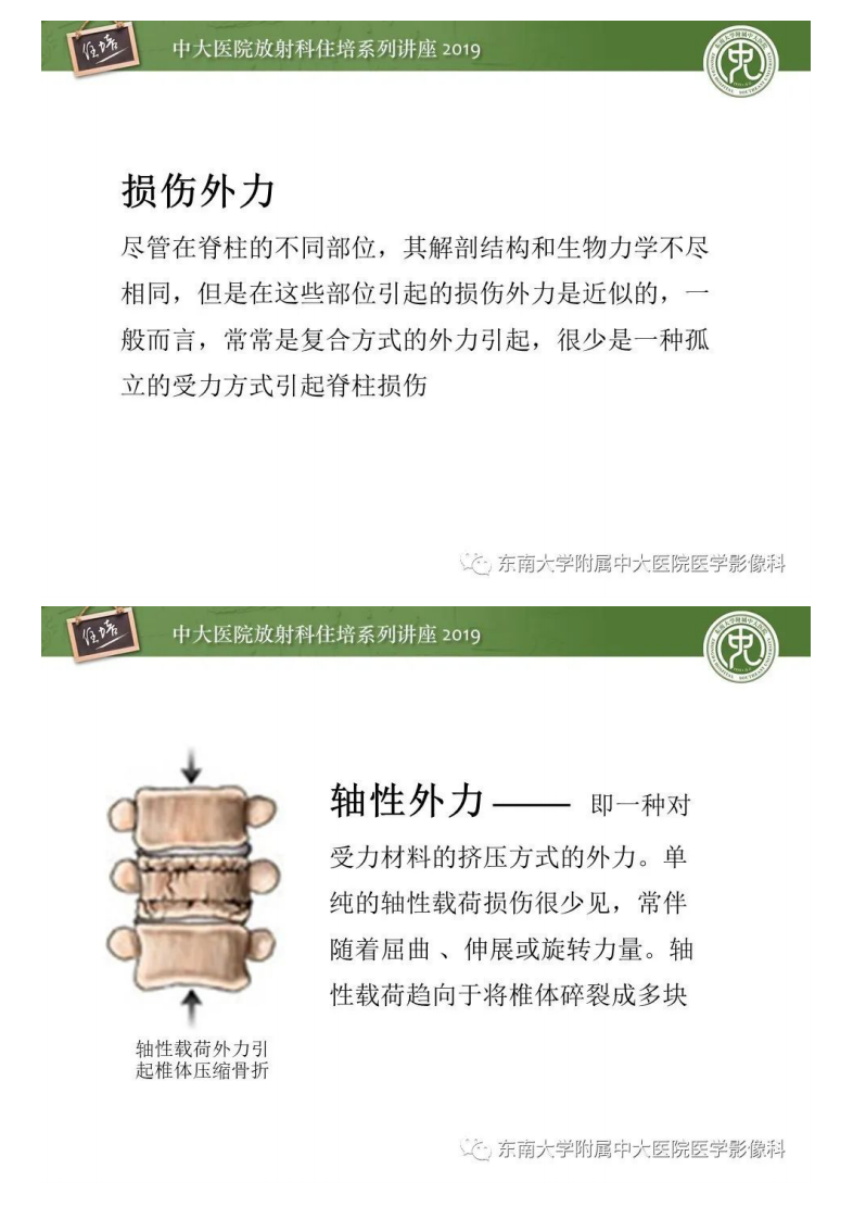 20200309_1【中大放射住培系列讲座】脊柱损伤.pdf 第3页