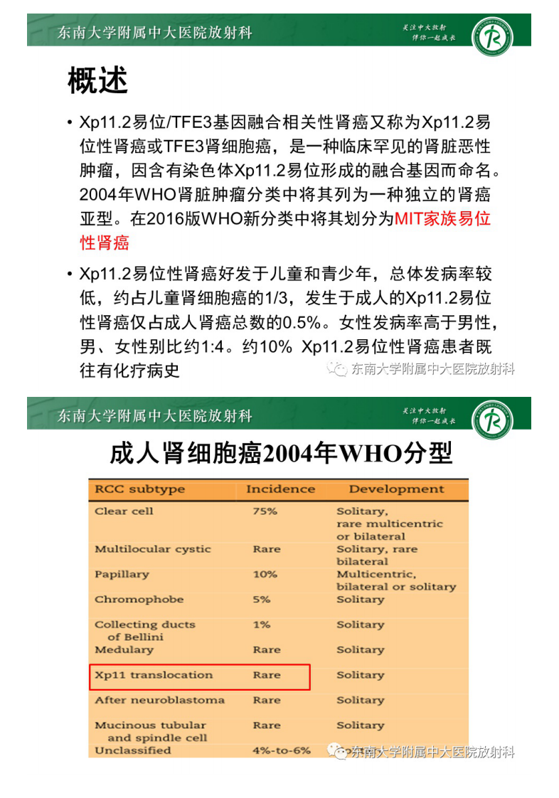 20210622_2【晨读结果公布】2021.06.22泌尿系统疾病——Xp11.2易位TFE3基因融合相关性肾癌.pdf 第5页