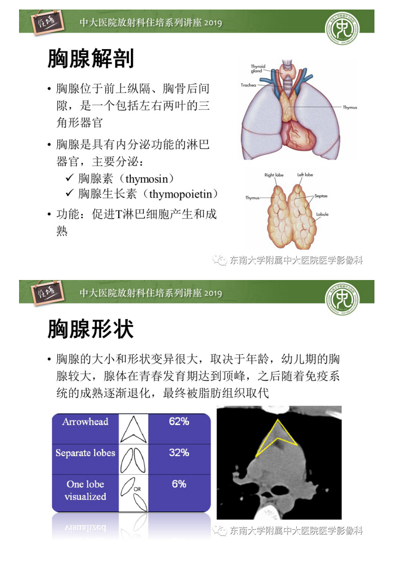 20200408_1【中大放射住培系列讲座】胸腺上皮性肿瘤的影像诊断及鉴别.pdf 第2页