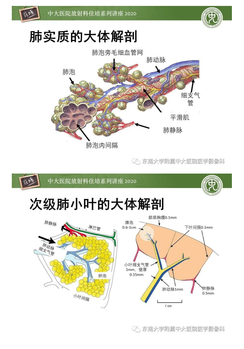 20200719_1【中大放射住培系列讲座】细支气管炎影像表现.pdf 第3页