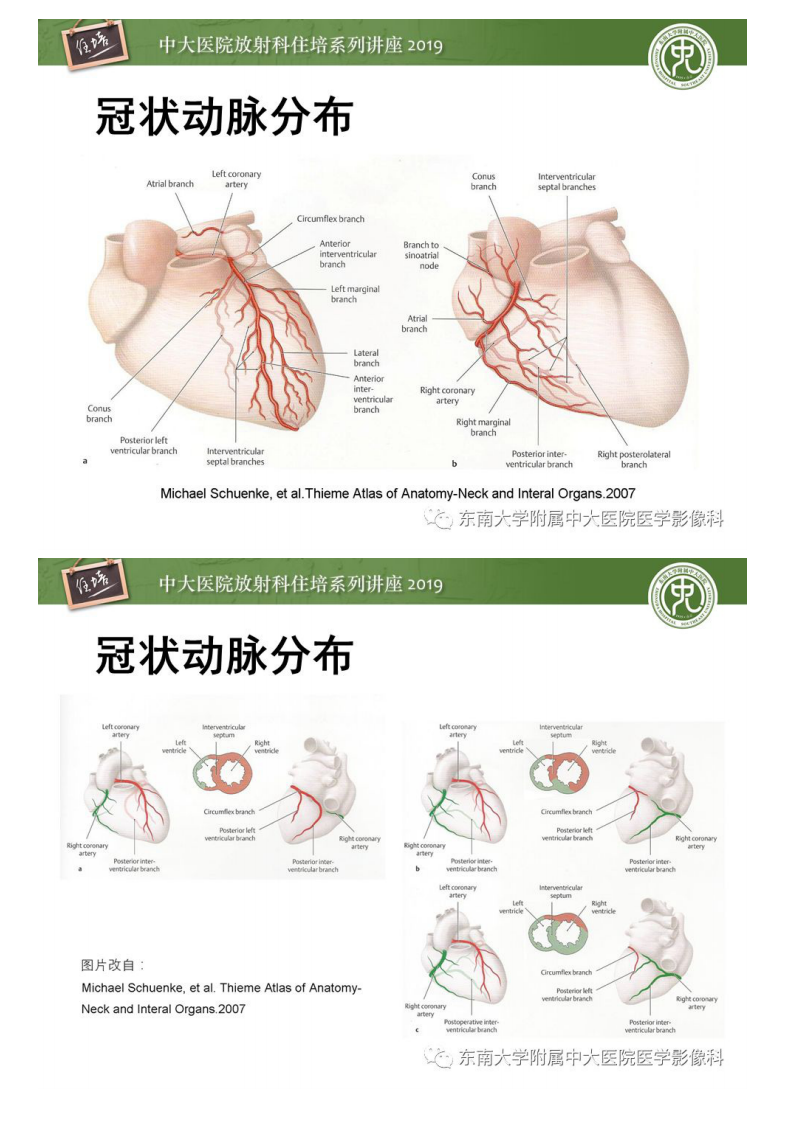 20190901_1【中大放射住培系列讲座第76期】冠状动脉CTA诊断流程.pdf 第4页